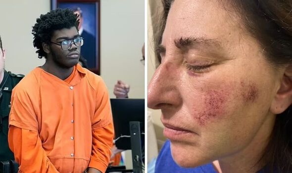 teacher beaten by student mobile phone florida